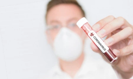 COVID-19: чи підпадає під визначення професійного захворювання? COVID-19: чи підпадає під визначення професійного захворювання?